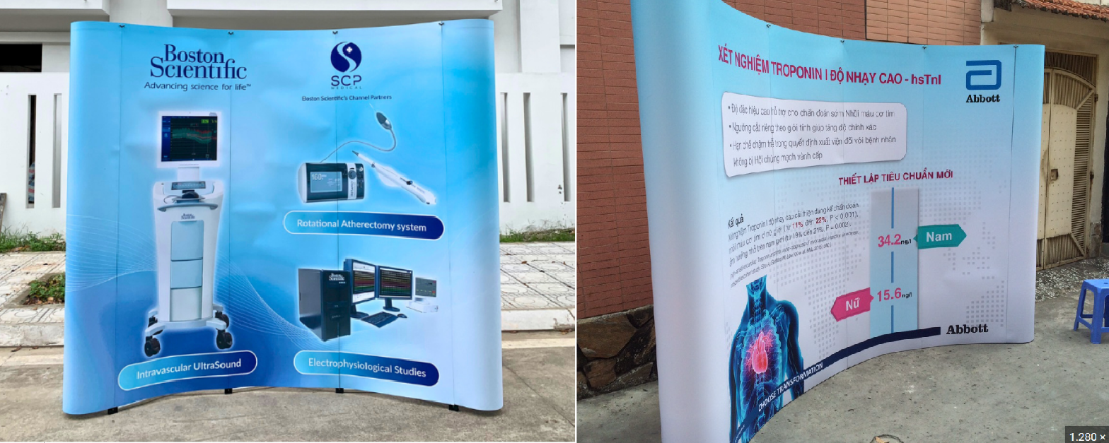 Backdrop Mạng Nhện Là Gì? Ưu Điểm & Ứng Dụng Thực Tế - cận cảnh